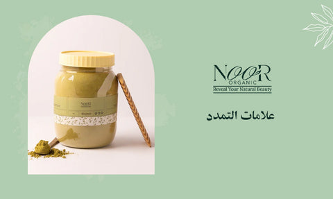 علامات التمدد