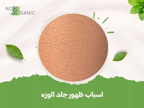 اسباب ظهور جلد الوزه